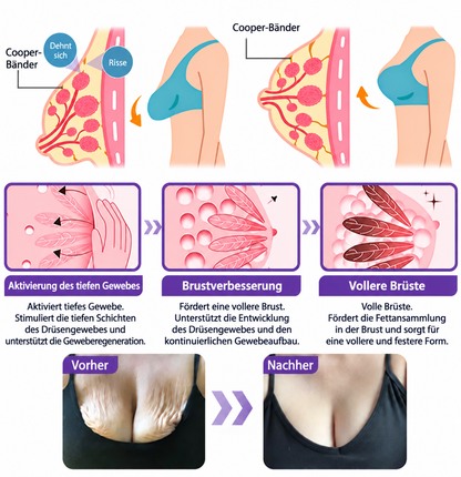 Natravor®🎗️ PDRN Multi-Peptid Straffende Körpercreme ｜ Anti-Aging Pflege, Feuchtigkeit, Straffung & Lifting für ein glatteres, ebenmäßigeres Hautbild