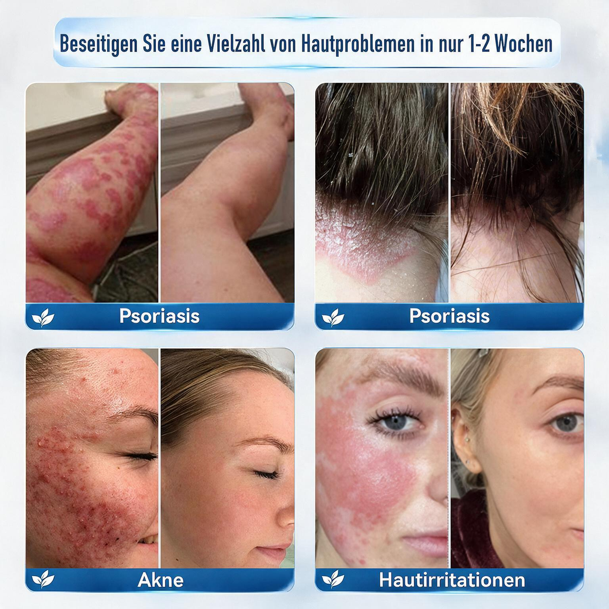 Natravor® 7-Tage Hauterneuerungs- & Reparaturcreme — Beruhigt Juckreiz und unterstützt die Hautregeneration (Sanfte, schmerzfreie Hautpflegeformel) 💎
