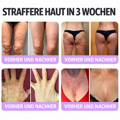 Natravor®🎗️ PDRN Multi-Peptid Straffende Körpercreme ｜ Anti-Aging Pflege, Feuchtigkeit, Straffung & Lifting für ein glatteres, ebenmäßigeres Hautbild