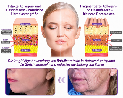 Natravor®🎗️ PDRN Multi-Peptid Straffende Körpercreme ｜ Anti-Aging Pflege, Feuchtigkeit, Straffung & Lifting für ein glatteres, ebenmäßigeres Hautbild