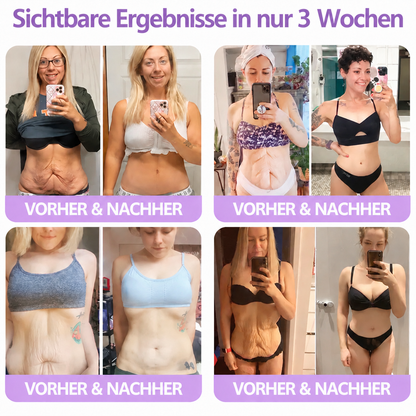 Natravor®🎗️ PDRN Multi-Peptid Straffende Körpercreme ｜ Anti-Aging Pflege, Feuchtigkeit, Straffung & Lifting für ein glatteres, ebenmäßigeres Hautbild