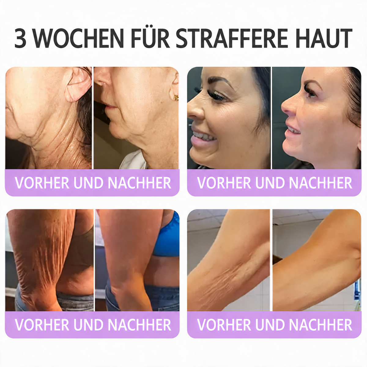 Natravor®🎗️ PDRN Multi-Peptid Straffende Körpercreme ｜ Anti-Aging Pflege, Feuchtigkeit, Straffung & Lifting für ein glatteres, ebenmäßigeres Hautbild