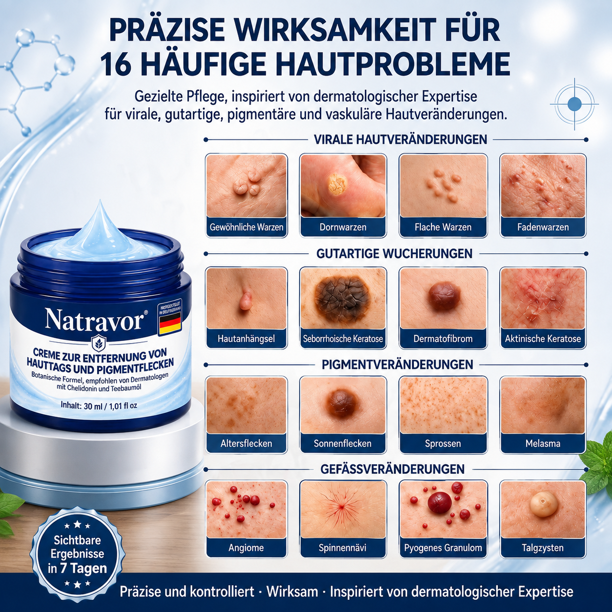 Natravor® 𝟕-𝐓𝐚𝐠𝐞 𝐇𝐚𝐮𝐭𝐚𝐧𝐡ä𝐧𝐠𝐬𝐞𝐥- & 𝐅𝐥𝐞𝐜𝐤𝐞𝐧-𝐄𝐧𝐭𝐟𝐞𝐫𝐧𝐮𝐧𝐠𝐬𝐜𝐫𝐞𝐦𝐞 (𝐒𝐜𝐡𝐦𝐞𝐫𝐳𝐟𝐫𝐞𝐢𝐞 𝐅𝐨𝐫𝐦𝐞𝐥 – 𝐨𝐡𝐧𝐞 𝐍𝐚𝐫𝐛𝐞𝐧) 🎉