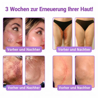 Natravor®🎗️ PDRN Multi-Peptid Straffende Körpercreme ｜ Anti-Aging Pflege, Feuchtigkeit, Straffung & Lifting für ein glatteres, ebenmäßigeres Hautbild