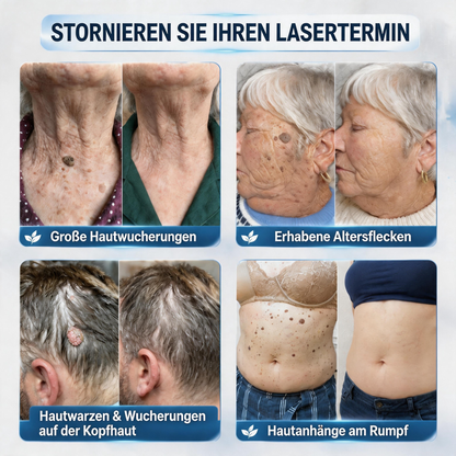 Natravor® 𝟕-𝐓𝐚𝐠𝐞 𝐇𝐚𝐮𝐭𝐚𝐧𝐡ä𝐧𝐠𝐬𝐞𝐥- & 𝐅𝐥𝐞𝐜𝐤𝐞𝐧-𝐄𝐧𝐭𝐟𝐞𝐫𝐧𝐮𝐧𝐠𝐬𝐜𝐫𝐞𝐦𝐞 (𝐒𝐜𝐡𝐦𝐞𝐫𝐳𝐟𝐫𝐞𝐢𝐞 𝐅𝐨𝐫𝐦𝐞𝐥 – 𝐨𝐡𝐧𝐞 𝐍𝐚𝐫𝐛𝐞𝐧) 🎉