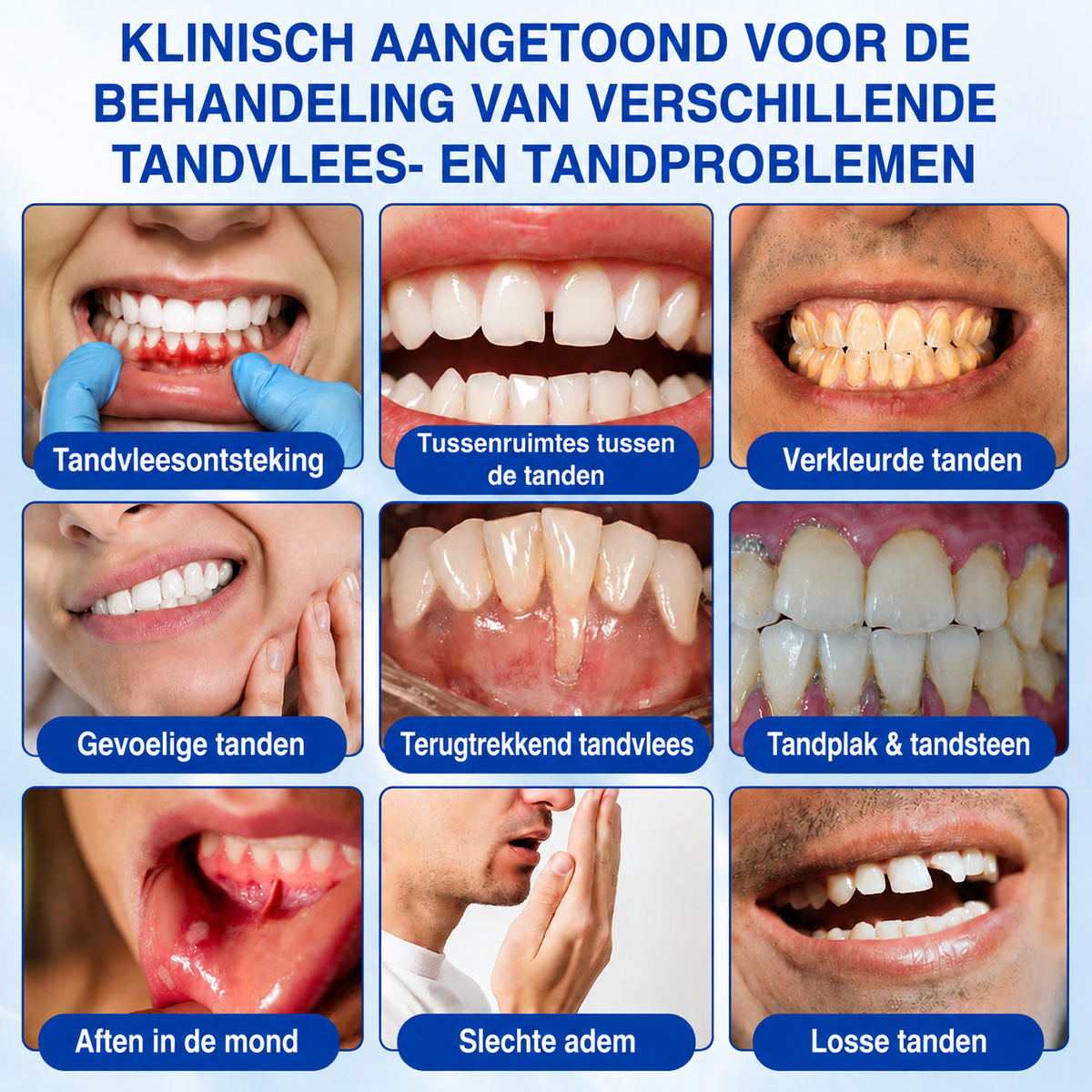🇳🇱🏅🦷🛡️𝐍𝐚𝐭𝐫𝐚𝐯𝐨𝐫® GumRevive Tandvlees- & Parodontale Verzorgingsgel